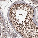 NXF2 Antibody in Immunohistochemistry (Paraffin) (IHC (P))