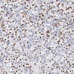 TCF2 Antibody in Immunohistochemistry (IHC)