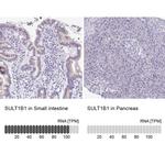 SULT1B1 Antibody