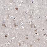 KIAA2026 Antibody in Immunohistochemistry (Paraffin) (IHC (P))