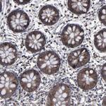 KIAA2026 Antibody in Immunohistochemistry (Paraffin) (IHC (P))