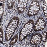KIAA2026 Antibody in Immunohistochemistry (IHC)