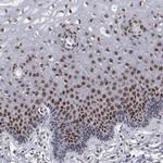 KDM6A Polyclonal Antibody