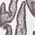 KDM6A Antibody in Immunohistochemistry (Paraffin) (IHC (P))
