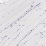 IFI16 Antibody in Immunohistochemistry (Paraffin) (IHC (P))