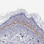 IFI16 Antibody in Immunohistochemistry (Paraffin) (IHC (P))