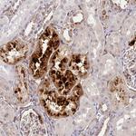 IGFBP7 Polyclonal Antibody