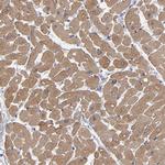 CCDC80 Antibody in Immunohistochemistry (Paraffin) (IHC (P))