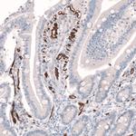 PLVAP Antibody in Immunohistochemistry (IHC)