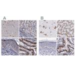 GOLIM4 Polyclonal Antibody