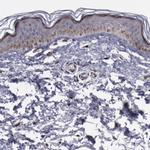 GOLIM4 Antibody in Immunohistochemistry (IHC)