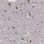 GOLIM4 Antibody in Immunohistochemistry (IHC)