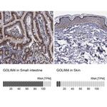 GOLIM4 Antibody