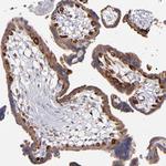 GLDC Polyclonal Antibody