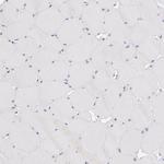 GLDC Antibody in Immunohistochemistry (Paraffin) (IHC (P))