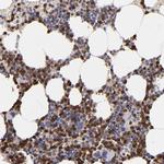 NCF2 Polyclonal Antibody