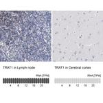TRIM Polyclonal Antibody
