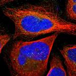 SLMAP Antibody in Immunocytochemistry (ICC/IF)