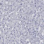 SLMAP Antibody in Immunohistochemistry (Paraffin) (IHC (P))
