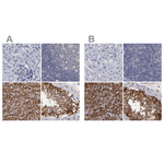 SLMAP Antibody in Immunohistochemistry (Paraffin) (IHC (P))