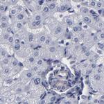 SLMAP Antibody in Immunohistochemistry (Paraffin) (IHC (P))
