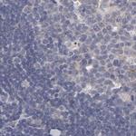SLMAP Antibody in Immunohistochemistry (Paraffin) (IHC (P))