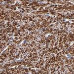 SLMAP Antibody in Immunohistochemistry (Paraffin) (IHC (P))