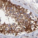 SLMAP Antibody in Immunohistochemistry (Paraffin) (IHC (P))