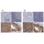 SLMAP Antibody in Immunohistochemistry (IHC)
