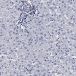 SLMAP Antibody in Immunohistochemistry (IHC)