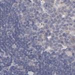SLMAP Antibody in Immunohistochemistry (IHC)
