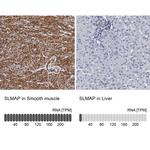 SLMAP Antibody