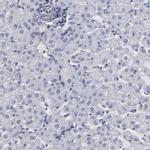 SLMAP Antibody in Immunohistochemistry (Paraffin) (IHC (P))