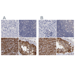 SLMAP Antibody in Immunohistochemistry (Paraffin) (IHC (P))