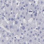 SLMAP Antibody in Immunohistochemistry (Paraffin) (IHC (P))