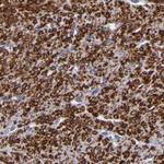 SLMAP Antibody in Immunohistochemistry (Paraffin) (IHC (P))