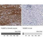 SLMAP Antibody in Immunohistochemistry (IHC)