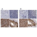 SLMAP Antibody in Immunohistochemistry (IHC)