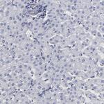 SLMAP Antibody in Immunohistochemistry (IHC)