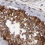 SLMAP Antibody in Immunohistochemistry (IHC)