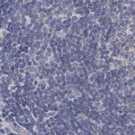 SLMAP Antibody in Immunohistochemistry (IHC)