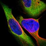 CARS Polyclonal Antibody