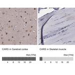 CARS Antibody in Immunohistochemistry (IHC)