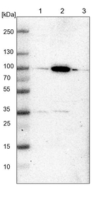 CARS Antibody in Western Blot (WB)