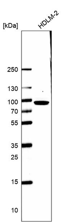CARS Antibody in Western Blot (WB)
