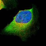 CARS Polyclonal Antibody