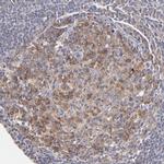 GCSAM Antibody in Immunohistochemistry (Paraffin) (IHC (P))