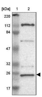 GCSAM Antibody in Western Blot (WB)