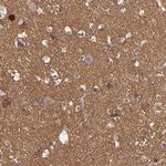 RPH3A Antibody in Immunohistochemistry (Paraffin) (IHC (P))