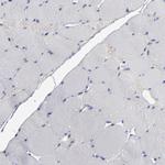 RPH3A Polyclonal Antibody